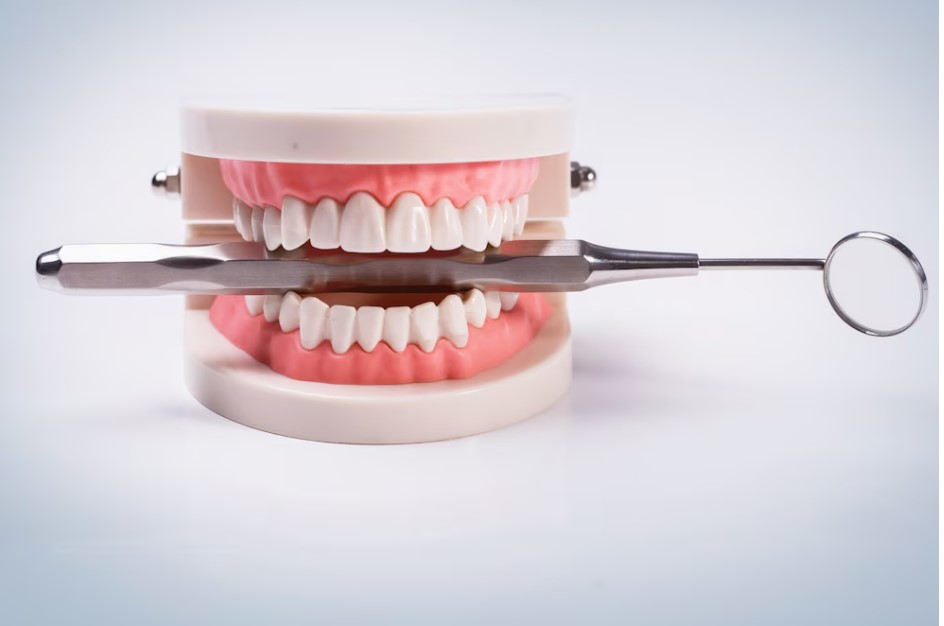 Reclaim Your Smile: Dental Implants in Gurgaon