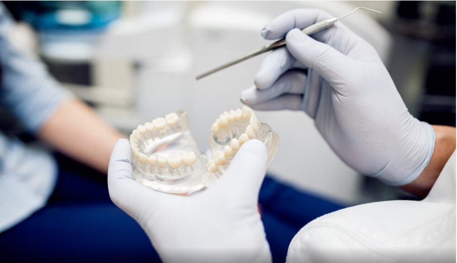 Everything You Need to Know About Dental Implants